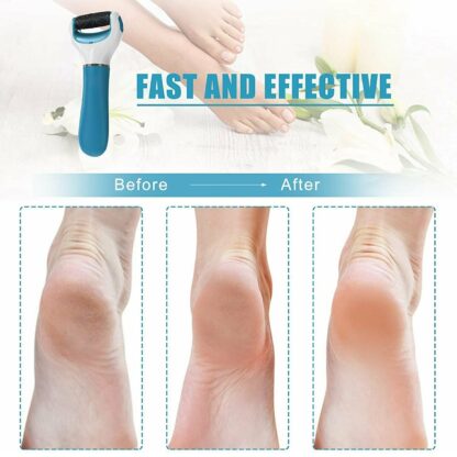 0229 Electronic Dry Foot File, Callous Remover for Feet, Electric Foot with Roller Hard and Dead Skin- Regular Coarse, Baby smooth feet in minutes. For in home padicure foot care, Battery Powered & USB (Battery not included) - Image 7